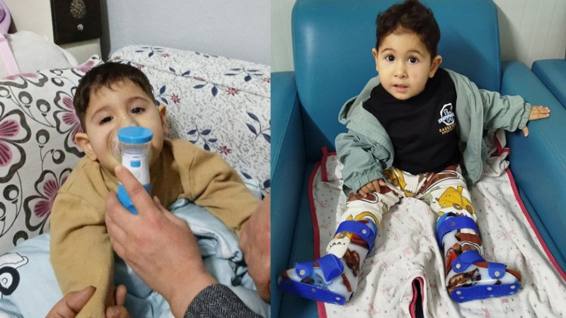 28 Aylık Umut Can Kurt Yaşam Mücadelesi Veriyor